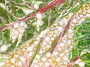 chickpeas and rainbow chard
